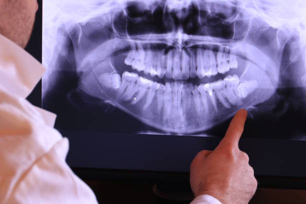 Best Emergency Treatment for Toothache in Notasulga, AL