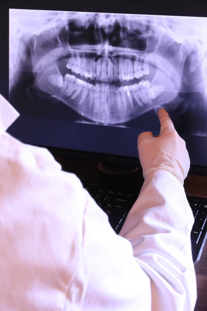 Best Emergency Broken Tooth Repair in Notasulga, AL